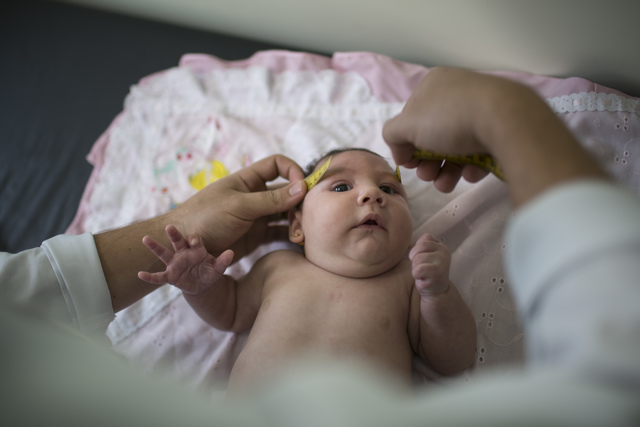 zika virus babies/ birth defects